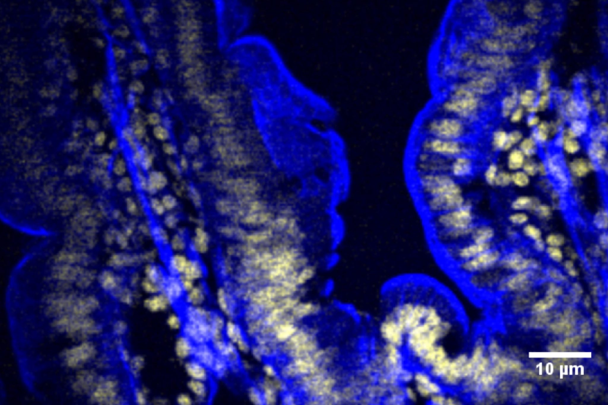 FYLA_fibraoptica-drsolberg-01