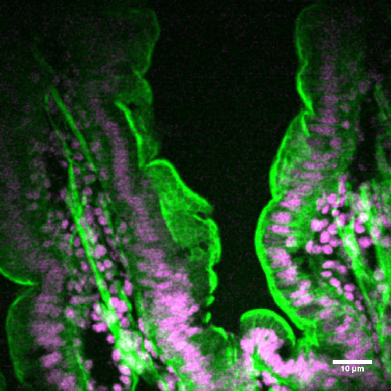 mouse-intestine-cyclone