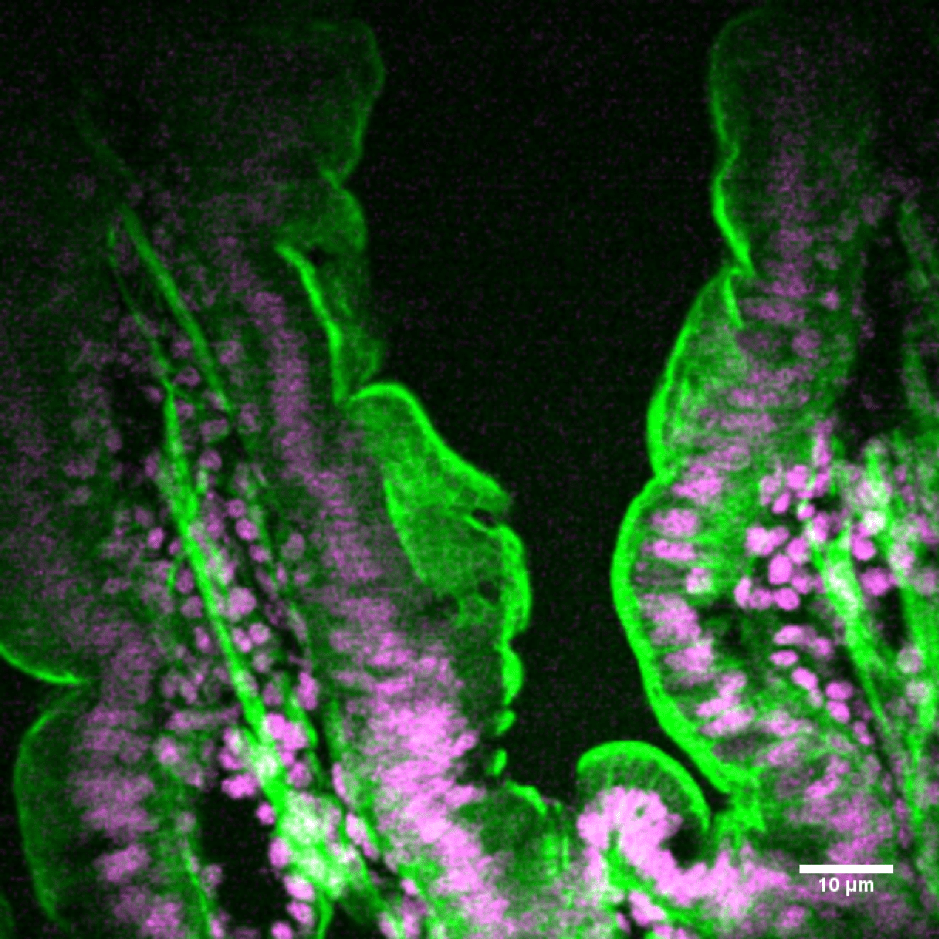 mouse-intestine-cyclone